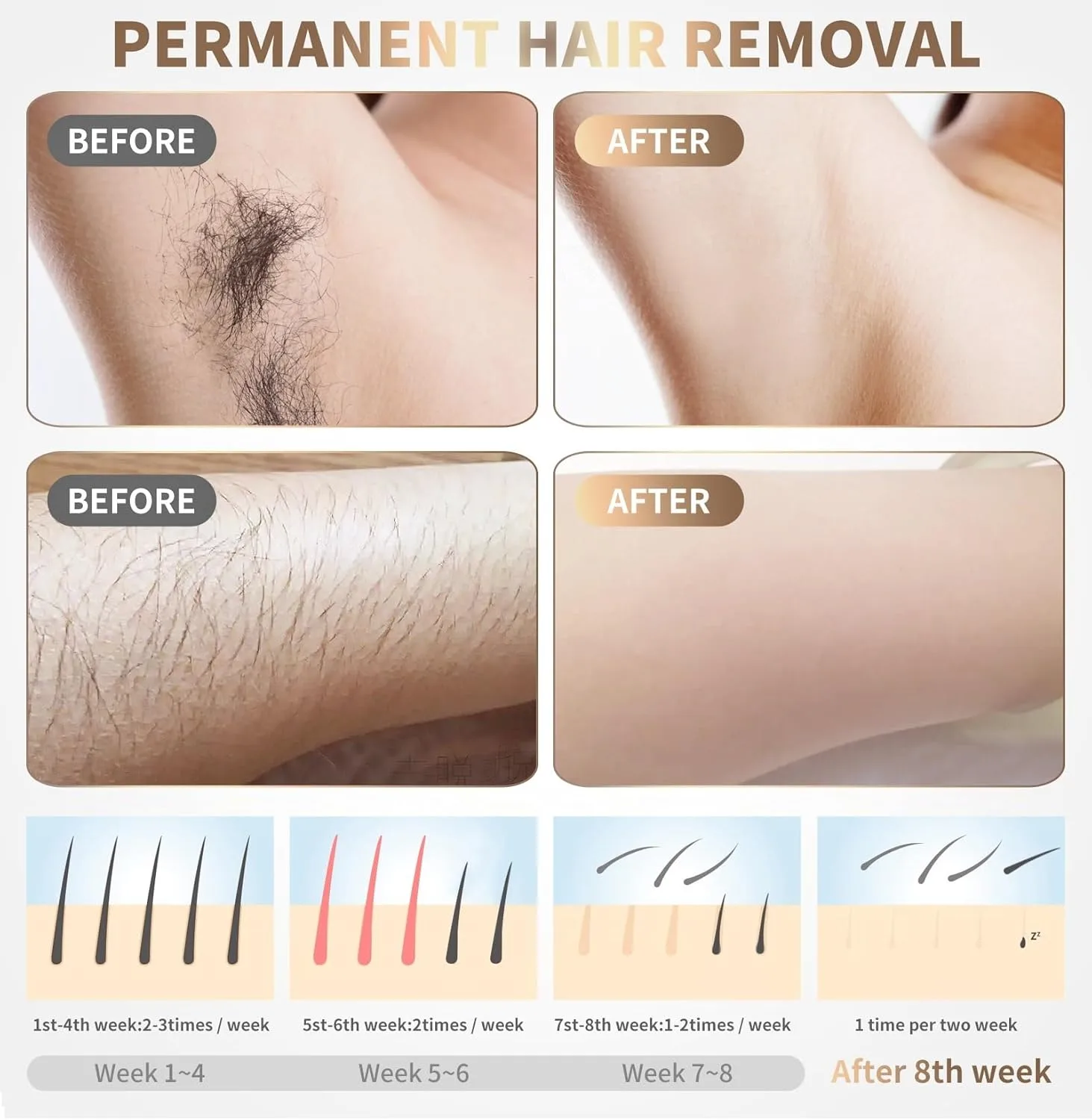 Home Use Beauty Device IPL Laser Hair Removal for Women and Men,999999 Flashes at-Home Laser Hair Removal Device thumbnail 3