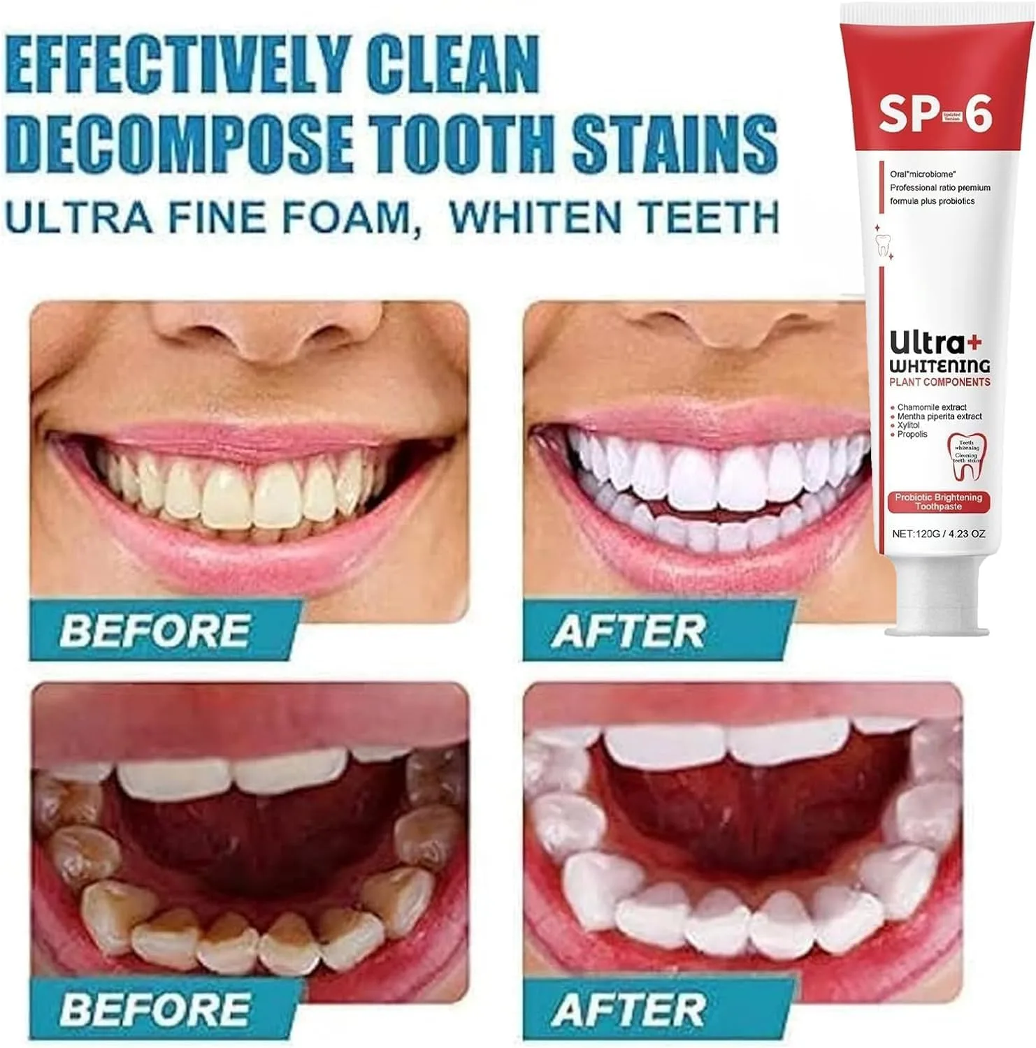 Super Probiotic SP-6 Ultra Whitening Toothpaste - Deep Cleaning Care, Fresh Breath thumbnail 3