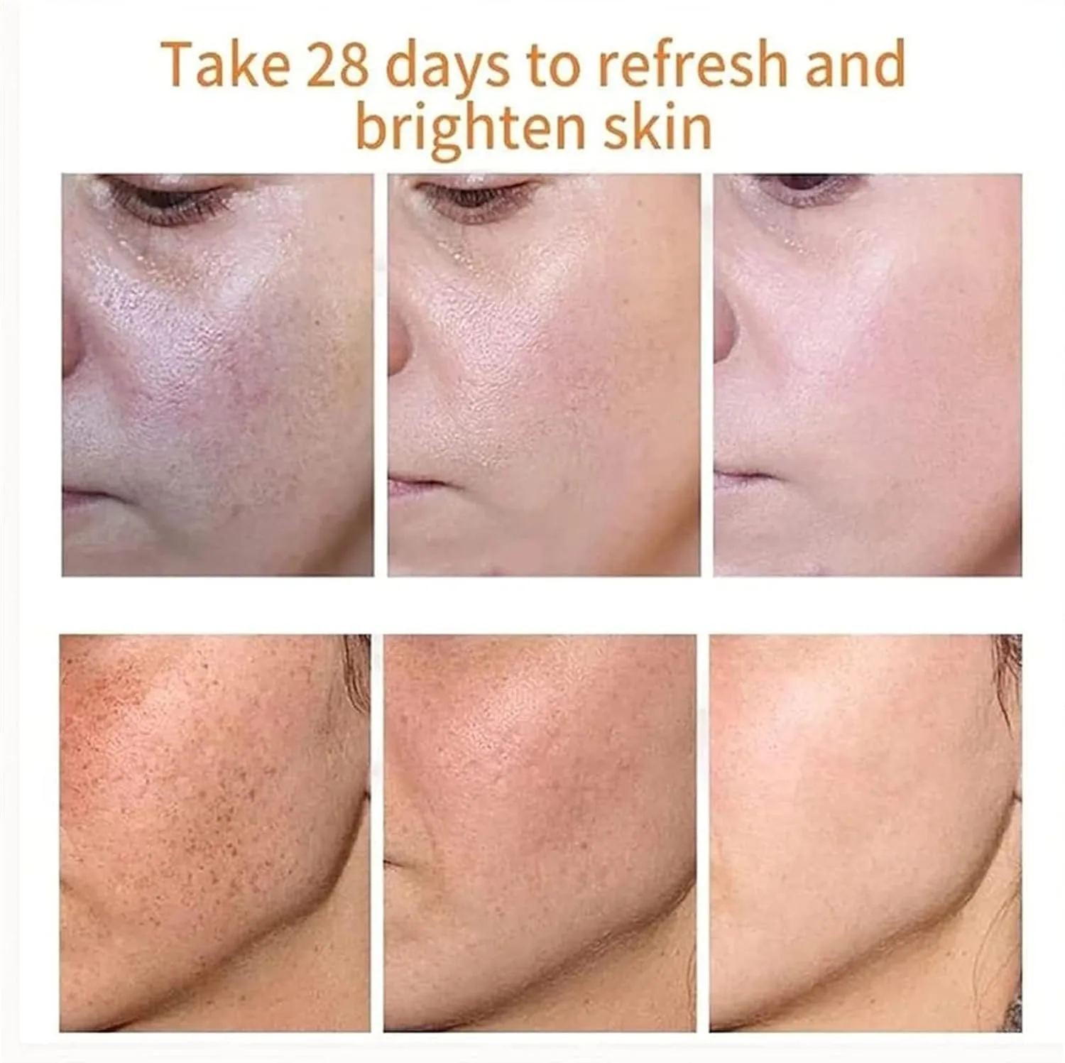 Japanese Melasma Cream, Dr Hancy White Spot Cream De China, Dark Spots Remover, Yunnan Herbal Correcting (1Pcs) thumbnail 4
