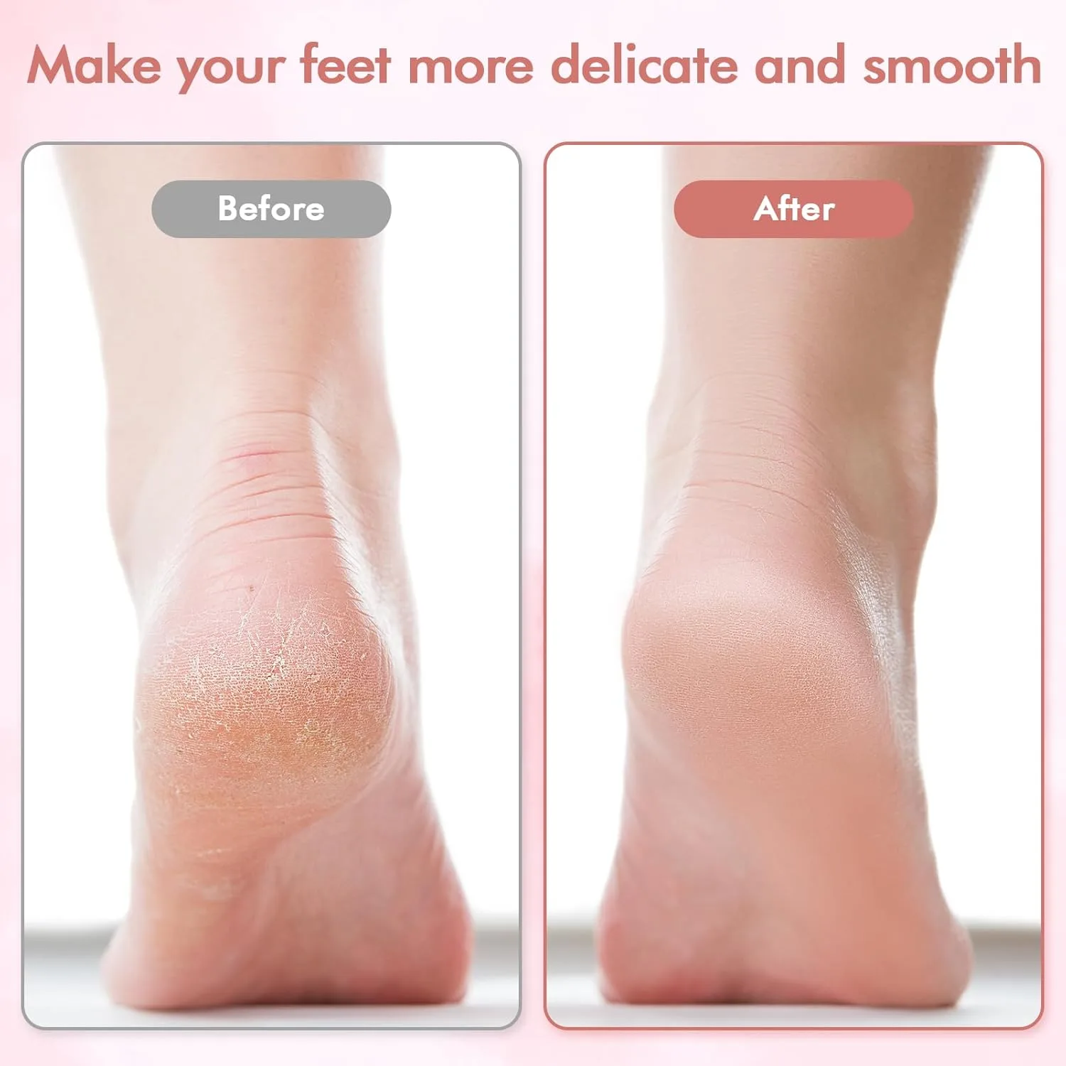 Electric Callus Remover for Feet, Electric Grinder for Foot File and Nail,Electronic Tool File and Callus Remover thumbnail 6