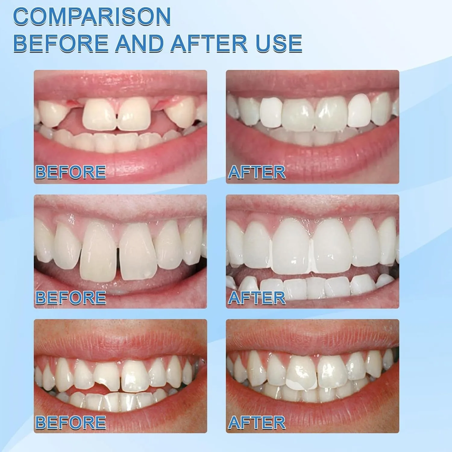Moldable False Teeth White Particles Reusable Non-toxic Temporarily Fill Regain Smile Cosplay DIY thumbnail 7