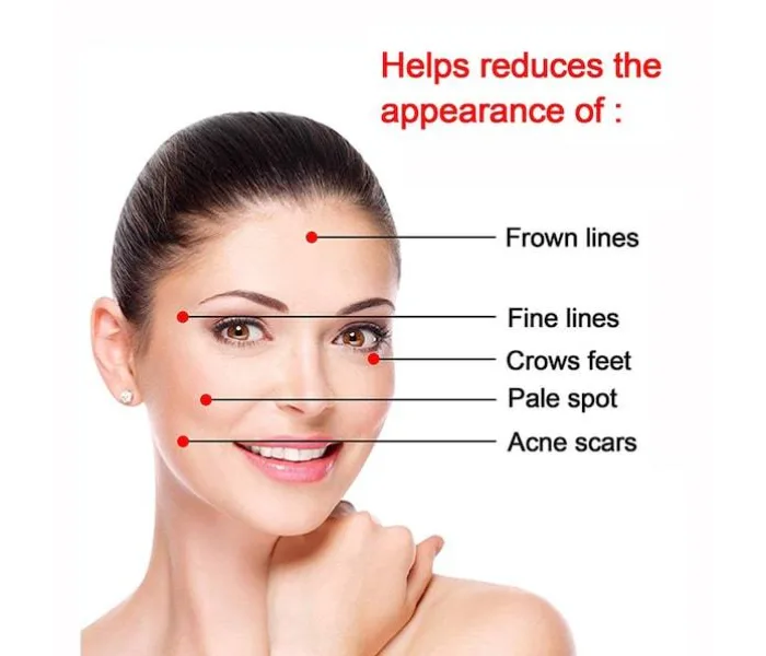 4 In 1 Derma Roller Stainless Set thumbnail 3