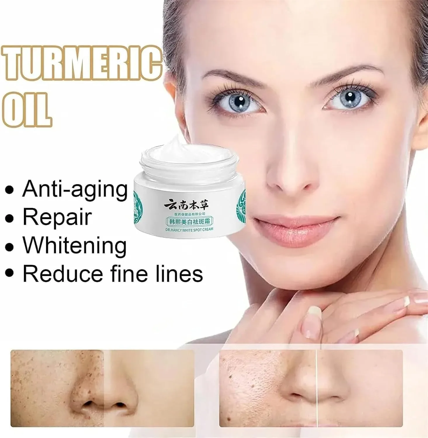 Japanese Melasma Cream, Dr Hancy White Spot Cream De China, Dark Spots Remover, Yunnan Herbal Correcting (1Pcs) thumbnail 5