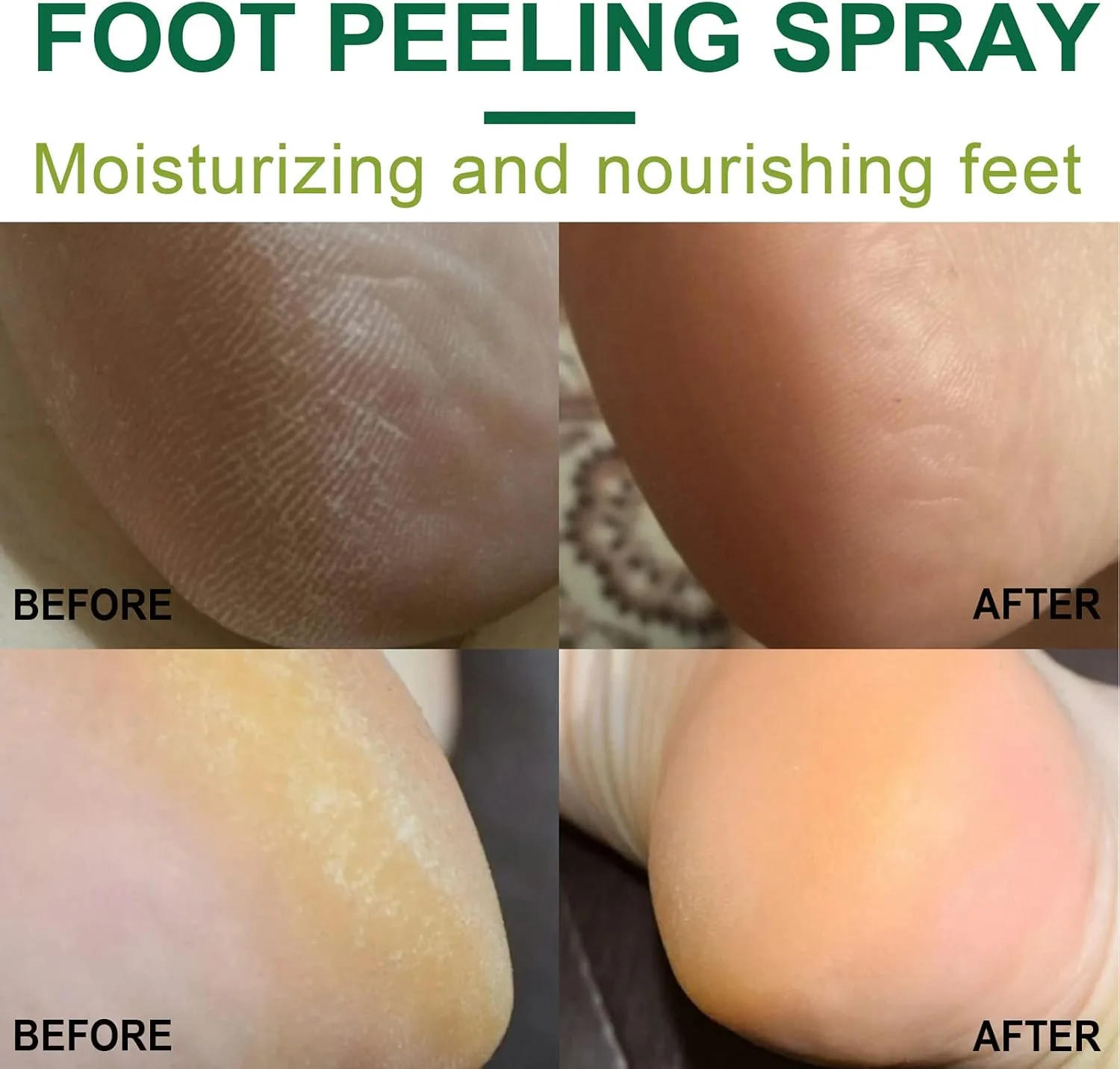 100ml Orange Foot Peeling Spray Soften Calluses Tender Feet Moisturizing Nourishing Foot Care thumbnail 2
