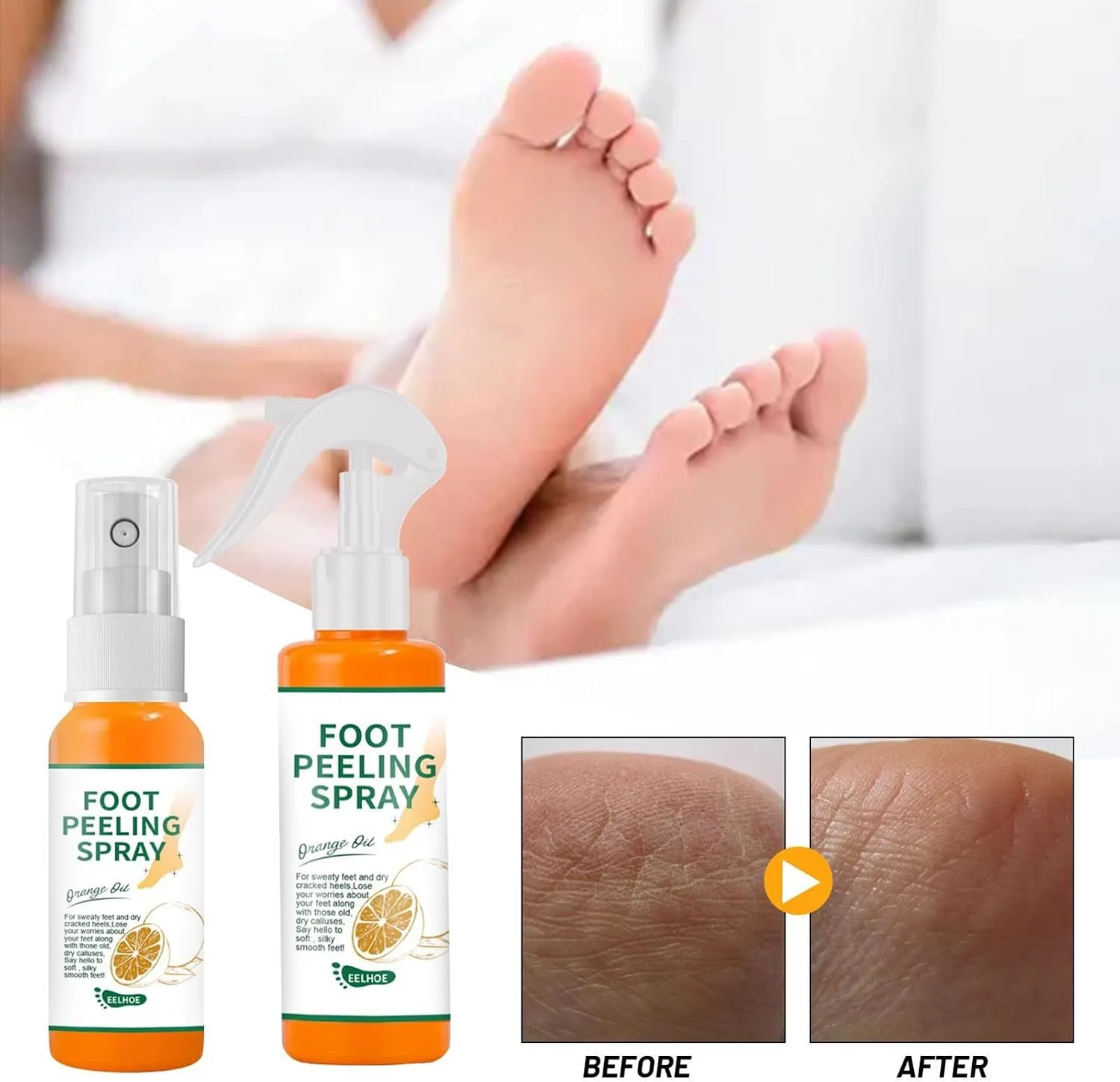 100ml Orange Foot Peeling Spray Soften Calluses Tender Feet Moisturizing Nourishing Foot Care thumbnail 5