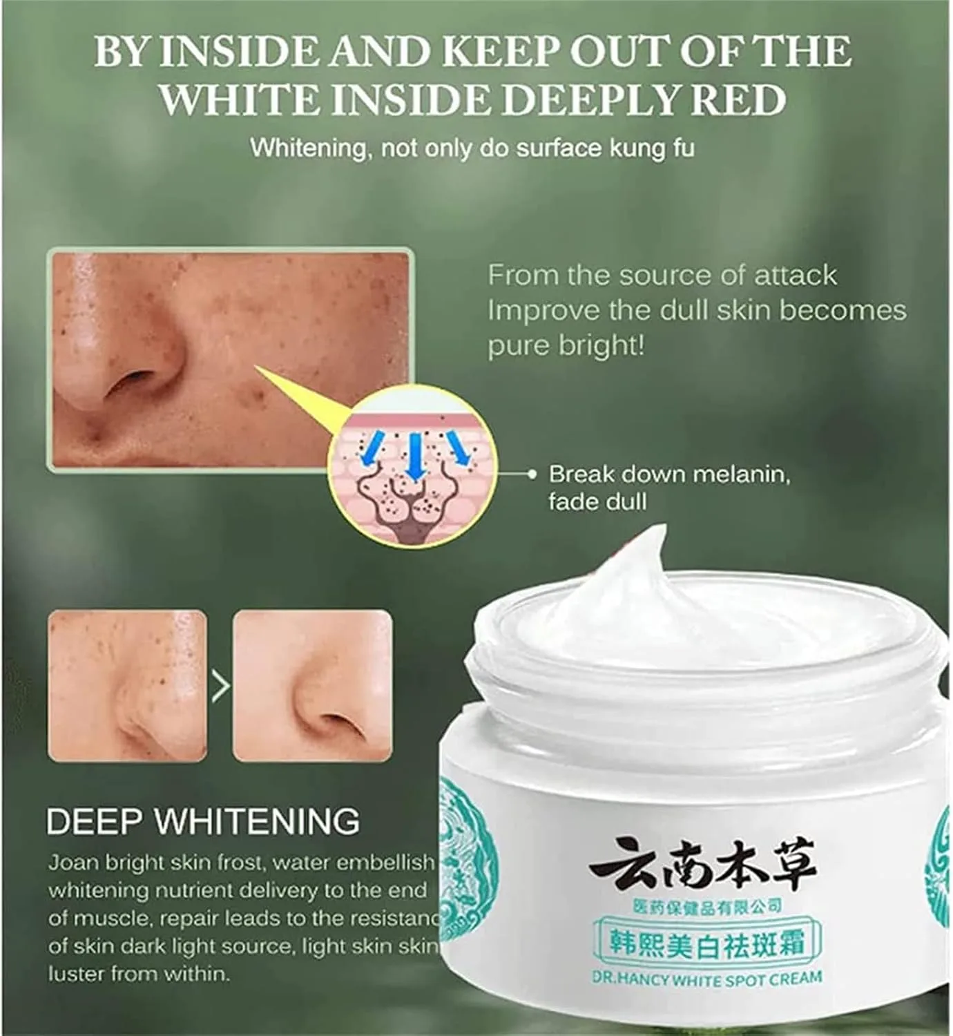 Japanese Melasma Cream, Dr Hancy White Spot Cream De China, Dark Spots Remover, Yunnan Herbal Correcting (1Pcs) thumbnail 7